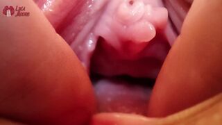 Extrém lyuk közelkép vad tágítással